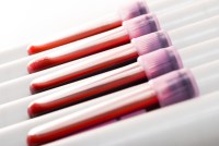 A photo of blood samples in vials.